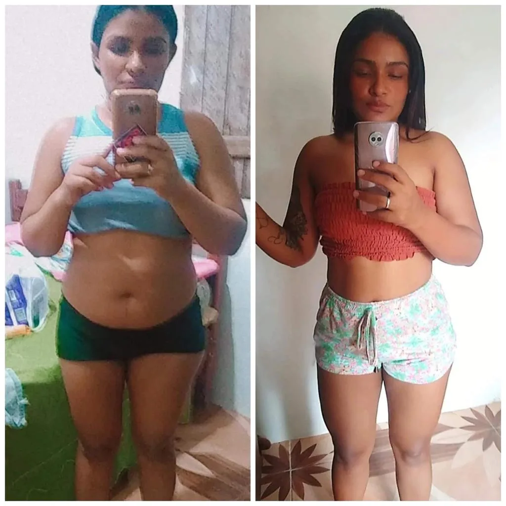 Antes e depois aluna 3 (1/2)