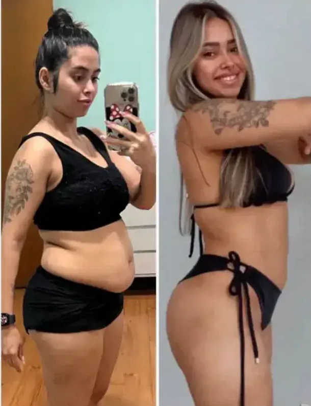 Antes e depois aluna 2